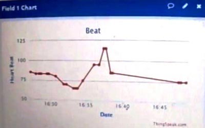 Arduino-based-Heart-rate-monitoring-over-thingspeak