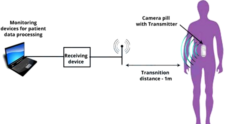 Electronic Pills Working