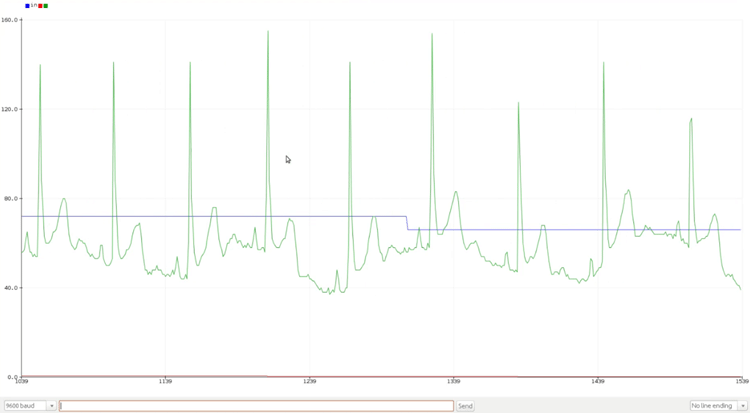 Arduino ECG Output