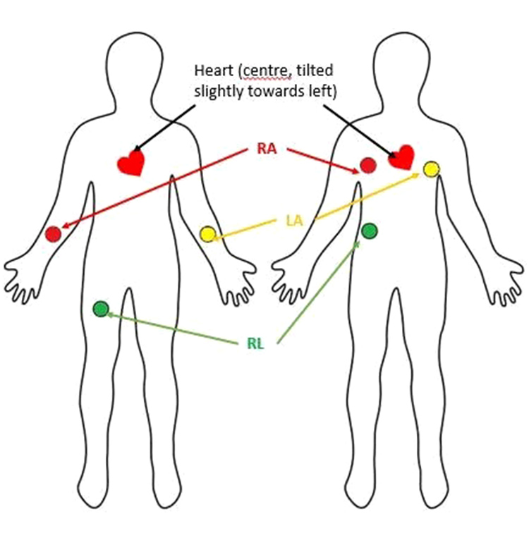 Sensor Electrodes Placement in Human Body